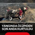 Yangında ölümden son anda kurtuldu: “Kaçmasaydım Yanacaktım”