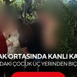 Sokak ortasında kanlı kavga: 14 yaşındaki çocuk üç yerinden bıçaklandı
