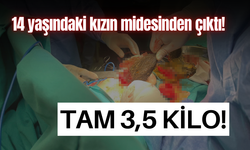 Tam 3,5 kilo! 14 yaşındaki kızın midesinden bakın ne çıktı