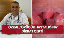 Viral enfeksiyonlara dikkat ! Öpücük hastalığı nedir ? İşte belirtileri, nedenleri ve tedavi yöntemleri