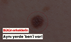 Bütün erkeklerin aynı yerde 'ben'i var!