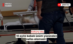 Anne ve babalar dikkat! 10 aylık bebeğin nefes borusuna üzüm kaçtı