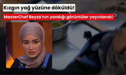 Kızgın yağ yüzüne döküldü! MasterChef Beyza'nın yandığı görüntüler yayınlandı! Acılar içinde kıvrandı...