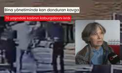 Bina yönetiminde kan donduran kavga: 70 yaşındaki kadının kaburgalarını kırdı