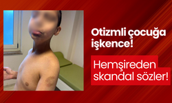 Otizmli çocuğa işkence! Hemşireden skandal sözler!