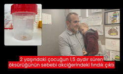 2 yaşındaki çocuk 1,5 aydır öksürük nöbeti geçiriyordu, sebebi akciğerindeki fındık çıktı