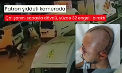 Parkta darp edilen çalışan yüzde 32 engelli kaldı, patron hakkında dava açıldı