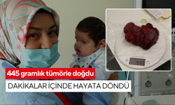 Mucize operasyon: 445 gramlık tümörle doğdu, dakikalar içinde hayata döndü