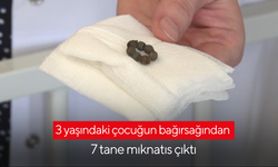 Çocuğun bağırsağından 7 tane mıknatıs çıktı
