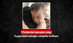 2 yaşındaki bebeğin vahşetle imtihanı! Annesinin, erkek arkadaşının darp ettiği bebek ölümle pençeleşiyor