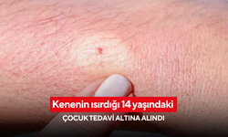 Kenenin ısırdığı 14 yaşındaki çocuk tedavi altına alındı