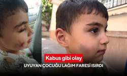 Kabus gibi olay: Uyuyan çocuğu lağım faresi ısırdı