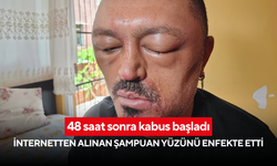 48 saat sonra kabus başladı: İnternetten alınan şampuan yüzünü enfekte etti
