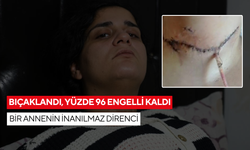 29 yaşındaki anne, eski eşi tarafından bıçaklandı… 4,5 aylık tedavi sürecinin ardından yeniden hayata tutundu