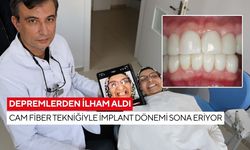Depremlerden ilham aldı: Cam fiber tekniğiyle implant dönemi sona eriyor