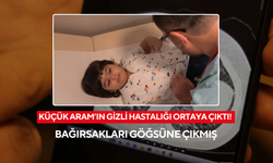 Küçük Aram’ın gizli hastalığı ortaya çıktı! Bağırsakları göğsüne çıkmış