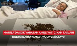 Manisa’da şok yaratan ameliyat! Çıkan taşları doktorlar sayamadı, yapay zeka saydı
