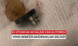 Bu oyuncak az kalsın can alıyordu! Minik bebeğin bağırsakları delindi