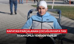 Kafatası parçalanan çocuğun kafa tası titanyumla yeniden yapıldı