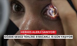 Batma, kaşıntı, kızarıklık… Nedeni alerji değil, gözdeki görünmez parazit