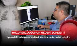 Bebeğin huzursuzluğunun nedeni şoke etti: Akciğere ilerleyen zımba teli