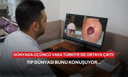 Dünyada sadece iki kez görüldü! Üçüncü vaka Türkiye’de ortaya çıktı