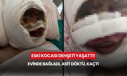 Eski kocası dehşeti yaşattı! Evinde bağladı, asit döktü, kaçtı