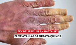 Genç kadınlarda daha sık görülüyor! El ve ayaklarda renk değişimi bu hastalığın habercisi