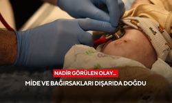 Nadir görülen olay... Mide ve bağırsakları dışarıda doğdu