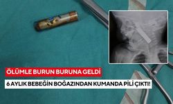 Ölümle burun buruna geldi: 6 aylık bebeğin boğazından kumanda pili çıktı!