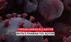 Sessiz başlıyor, hızla öldürüyor! Ölüm oranı %75'e varan Nipah virüsü alarmı!