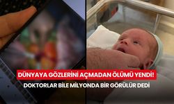 Dünyaya gözlerini açmadan ölümü yendi! Doktorlar bile milyonda bir görülür dedi