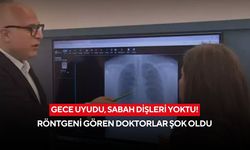 Gece uyudu, sabah dişleri yoktu! Doktorların gördüğü gerçek akıllara durgunluk verdi