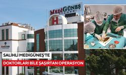 Kendisi bile şaşırdı: Safra kesesi değil sanki taş ocağı!