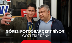 Gören fotoğraf çektiriyor! Gözleri tam 3 renk: ''Annem duasında demiş''