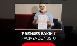 Güzelleşmek için gitti, yanıklarla döndü! 2 yaşındaki oğlu annesinden korktu...