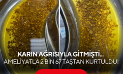 Karın ağrısıyla gitmişti... Ameliyatla 2 bin 67 taştan kurtuldu!