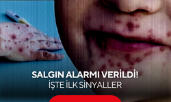 Kreş ve anaokullarında hızla yayılıyor: Bu yıl beklenenden erken başladı