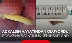 Az kalsın hayatından oluyordu! Boğazına 5 santimlik kemik saplandı