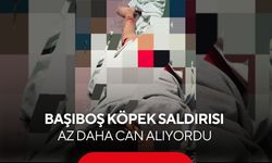 Okuldan eve dönüyordu, ölümle burun buruna geldi... 5 köpek bir çocuğa saldırdı...