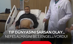Tıp dünyasını sarsan olay! Tam 8 kilo ağırlığında, 50 santim boyunda...