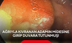 Böyle vaka nadir görülür! Ağrıyla kıvranan adamın midesine girip duvara tutunmuş