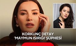 Kızılcık Şerbeti'nin Işıl'ı Ece İrtem’in ölümüyle ilgili korkunç detay: Maymun ısırığı şüphesi