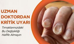 Uzman Doktordan Kritik Uyarı: Tırnaklarınızdaki Bu Değişikliği Hafife Almayın