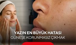 Uzmandan Yaz Uyarısı! Güneş, Deniz ve Klor Cilt ve Saçı Sessizce Yıpratıyor