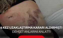 Bıçaklı saldırıya uğrayan kadın yaşadıklarını anlattı... "Bıçak kırılmasaydı yaşayamazdım"