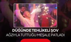 Düğünde korku dolu anlar! Ağzındaki meşale yüzünde patladı...