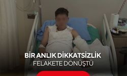 Kolonya döküp çakmağı çakınca ölümden döndü... 15 yaşındaki çocuğun vücudunun yüzde 25'i yandı...