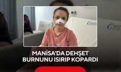 Manisa'da dehşet! Burnu ısırılarak koparılan kadın: Canımın acısıyla balkondan atlamayı düşündüm