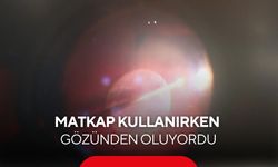 Matkap kullanırken fırlayan vida parçası gözüne isabet etti! “Gözlük kullanmadım, böyle oldu”